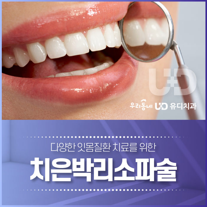 부산치과추천 치은박리소파술 잘하는 곳은?